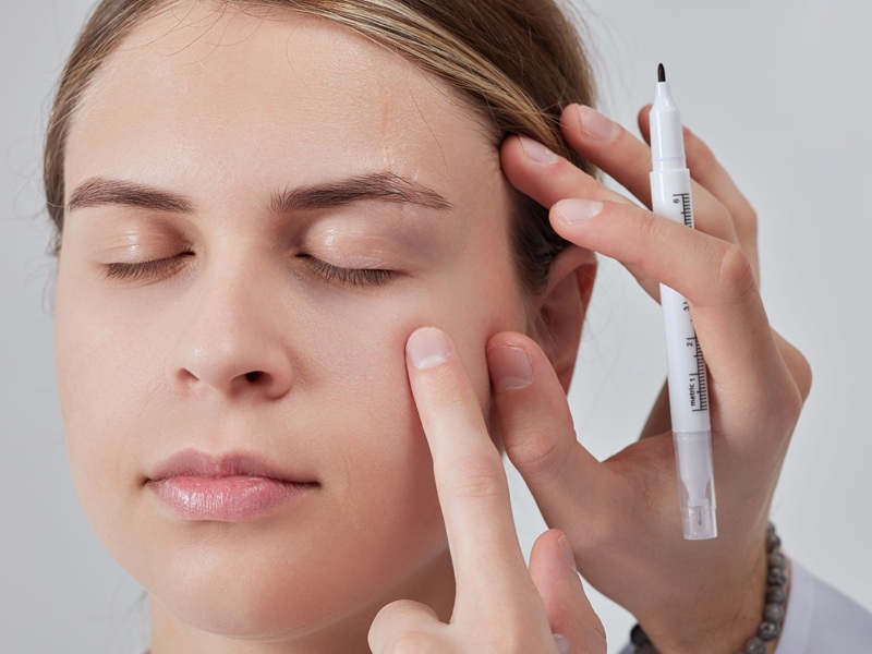 Ptosisoperatie Skin & Vision Clinic